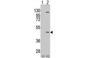 Western blot analysis of PRMT8 antibody and 293 cell lysate either nontransfected (Lane 1) or transiently transfected with the PRMT8 gene (2). (PRMT8 antibody  (AA 344-373))
