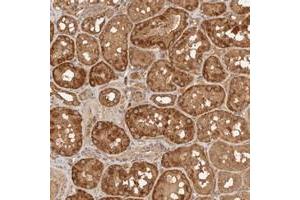 Immunohistochemical staining of human kidney with FAM180B polyclonal antibody  shows strong cytoplasmic positivity in tubular cells at 1:50-1:200 dilution. (FAM180B antibody)
