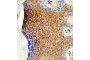 Immunohistochemistry analysis in formalin-fixed and paraffin-embedded human skin tissue reacted with GALNT3 Antibody (Center) followed which was peroxidase-conjugated to the secondary antibody, followed by DAB staining. (GALNT3 antibody  (Middle Region))