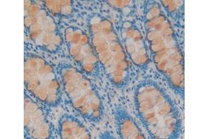 #VALUE! (MED1 antibody  (AA 1-212))