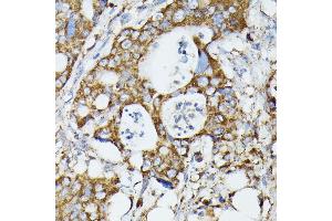Immunohistochemistry (IHC) image for anti-Mitochondrial Translational Initiation Factor 2 (MTIF2) (AA 428-727) antibody (ABIN7268591)