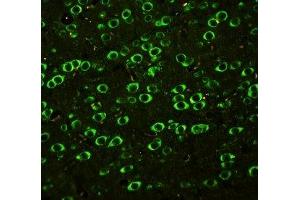 IF: SSH3BP1 antibody testing of rat brain tissue (ABI1 antibody  (C-Term))