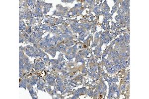 IHC analysis of AFM using anti-AFM antibody (ABIN7601674). (Afamin antibody  (AA 41-584))