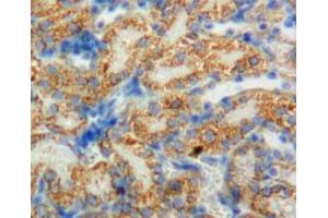 Used in DAB staining on fromalin fixed paraffin-embedded adrenal tissue (CYP11B1 antibody  (AA 1-498))