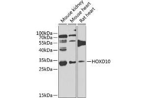 Western blot analysis of extracts of various cell lines, using HOXD10 antibody (ABIN6131767, ABIN6141956, ABIN6141957 and ABIN6223612) at 1:1000 dilution. (HOXD10 antibody  (AA 1-240))