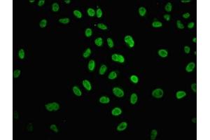 Immunofluorescence staining of Hela cells (treated with 30mM sodium butyrate for 4h) with ABIN7139176 at 1:12.