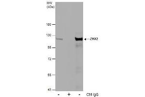 IP Image Immunoprecipitation of ZHX2 protein from MCF-7 whole cell extracts using 5 μg of ZHX2 antibody [C1C3], Western blot analysis was performed using ZHX2 antibody [C1C3], EasyBlot anti-Rabbit IgG  was used as a secondary reagent. (ZHX2 antibody  (C-Term))