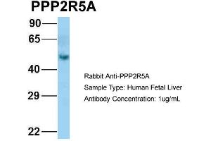Host: Rabbit Target Name: PPP2R5A Sample Type: Human Fetal Liver Antibody Dilution: 1. (PPP2R5A antibody  (N-Term))