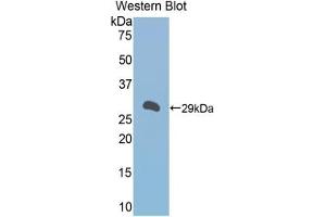 Detection of Recombinant a1BG, Mouse using Polyclonal Antibody to Alpha-1-B-Glycoprotein (a1BG) (A1BG antibody  (AA 22-219))