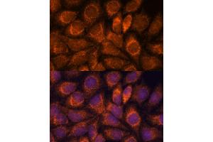 Immunofluorescence analysis of HeLa cells using MRPS14 antibody (ABIN7270013) at dilution of 1:100. (RPS14 antibody  (AA 1-128))