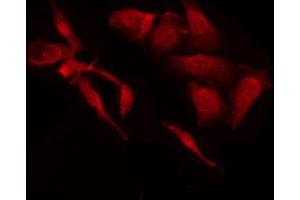 ABIN6269309 staining HeLa by IF/ICC. (E2F1 antibody  (C-Term))
