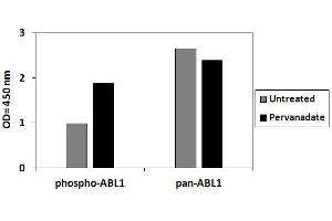 Jurkat cells were treated with Pervanadate. (ABL1 ELISA Kit)