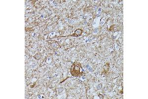 Immunohistochemistry (IHC) image for anti-FK506 Binding Protein 1B, 12.6 KDa (FKBP1B) (AA 1-80) antibody (ABIN7267212)