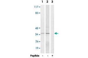 Western blot analysis of extracts from HepG2 cells (Lane 1) and Jurkat cells (Lane 2 and lane 3), using ELOVL1 polyclonal antibody .