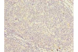 Immunohistochemistry of paraffin-embedded human tonsil tissue using ABIN7164637 at dilution of 1:100 (PCOLCE2 antibody  (AA 24-415))