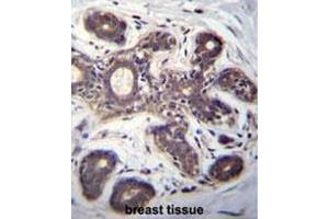 EIF2B1 Antibody (Center) immunohistochemistry analysis in formalin fixed and paraffin embedded human breast tissue followed by peroxidase conjugation of the secondary antibody and DAB staining. (EIF2B1 antibody  (Middle Region))