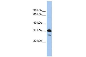 WB Suggested Anti-RAP1B Antibody Titration: 0.