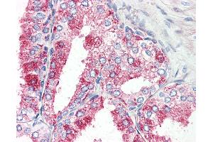 Anti-GPR27 antibody IHC of human prostate. (GPR27 antibody  (Internal Region))