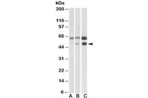 Western blot testing of human cerebellum [A], mouse brain [B], and rat brain [C] lysates with CAMK2A antibody at 0. (CAMK2A antibody)