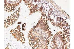 IHC analysis of CDK5 using anti-CDK5 antibody (ABIN6719393).