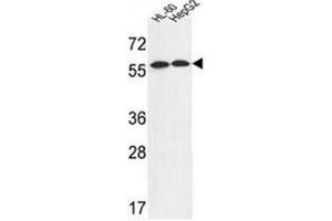 Western blot analysis of FANCC Antibody (C-term) in HL-60,HepG2 cell line lysates (35ug/lane).