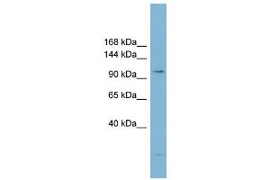 WB Suggested Anti-ACLY  Antibody Titration: 0. (ACLY antibody  (Middle Region))