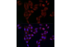 Immunofluorescence analysis of HeLa cells using Alph-adaptin/ Rabbit pAb (ABIN6130980, ABIN6136955, ABIN6136957 and ABIN6221039) at dilution of 1:50 (40x lens).