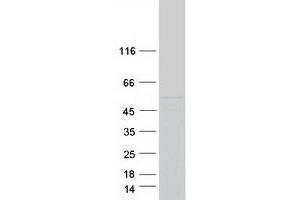 Validation with Western Blot (CYP26A1 Protein (Transcript Variant 1) (Myc-DYKDDDDK Tag))