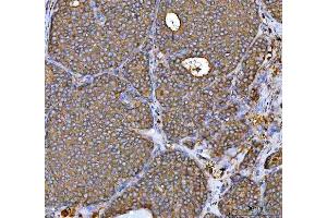 IHC analysis of MRPS22 using anti-MRPS22 antibody (ABIN7600613). (MRPS22 antibody  (AA 21-329))