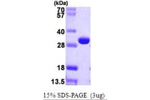 DeoC (AA 1-259) protein (His tag)