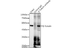 Immunoprecipitation analysis of 300 μg extracts of 293T cells using 3 μg β-Tubulin antibody (ABIN7271043). (TUBB antibody)