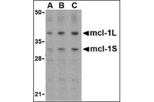 Western blot analysis of Mcl-1 in Raji cell lysates with AP30549PU-N (IN) at (A) 0. (MCL-1 antibody  (Center))