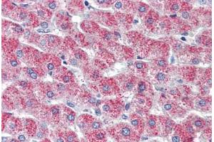 Liver, Human: Formalin-Fixed, Paraffin-Embedded (FFPE) (G Protein-Coupled Receptor 126 antibody  (N-Term))