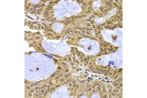 Immunohistochemistry (Paraffin-embedded Sections) (IHC (p)) image for anti-Exportin 5 (XPO5) (AA 925-1204) antibody (ABIN6150299)