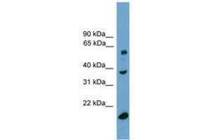 Image no. 1 for anti-Transducin (Beta)-Like 1, Y-Linked (TBL1Y) (C-Term) antibody (ABIN6744913) (TBL1Y antibody  (C-Term))