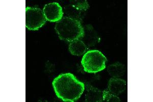 Immunofluorescence (IF) image for anti-HHV6 gQ1 (AA 3-422) antibody (ABIN2452012) (HHV6 gQ1 (AA 3-422) antibody)