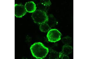 Immunofluorescence (IF) image for anti-HHV6 gQ1 (AA 3-422) antibody (ABIN2452012)