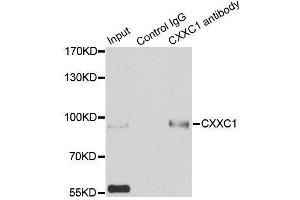 Immunoprecipitation analysis of 200ug extracts of HepG2 cells using 3ug CXXC1 antibody.