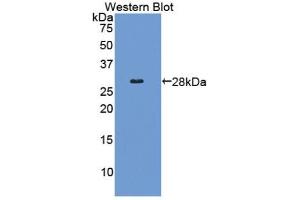 Detection of Recombinant COL4a2, Human using Polyclonal Antibody to Collagen Type IV Alpha 2 (COL4a2) (COL4a2 antibody  (AA 1487-1703))