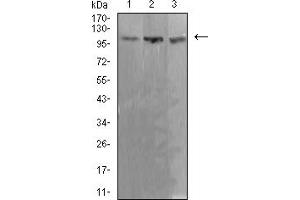 Western blot analysis using ADAR mouse mAb against Ramos (1), K562 (2), and Jurkat (3) cell lysate.