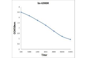 Antigen: 2 µg/100 µL  Primary: Antiserum, 1:500, 1:1000, 1:2000, 1:4000, 1:8000, 1:16000, 1:32000;  Secondary: HRP conjugated Rabbit Anti-Goat IgG at 1: 5000;  TMB staining Read the data in Microplate Reader by 450nm. (BOD1 antibody  (AA 51-150))