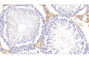 Immunohistochemistry (IHC) image for anti-Pregnancy Zone Protein (PZP) (AA 1251-1500) antibody (ABIN7438814)