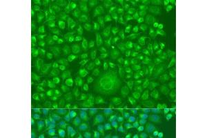 Immunofluorescence analysis of U2OS cells using IFNW1 Polyclonal Antibody at dilution of 1:100.