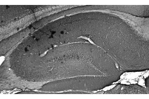 Adult rat hippocampus immunohistochemistry.