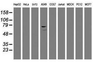Image no. 5 for anti-Coagulation Factor XIII, A1 Polypeptide (F13A1) antibody (ABIN1498151) (F13A1 antibody)