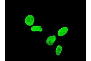 Immunofluorescence of monoclonal antibody to TBX3 on HeLa cell. (TBX3 antibody  (AA 311-410))