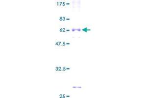 ROM1 Protein (AA 1-351) (GST tag)