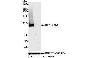Western Blotting (WB) image for anti-Hypoxia Inducible Factor 1, alpha Subunit (Basic Helix-Loop-Helix Transcription Factor) (HIF1A) (C-Term) antibody (ABIN7455213)