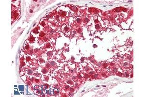 Immunohistochemistry (IHC) image for anti-Damage Specific DNA Binding Protein 1 (DDB1) (C-Term) antibody (ABIN184570)