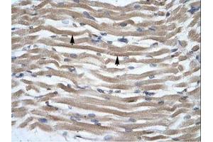 Image no. 1 for anti-Distal-Less Homeobox Protein 2 (DLX2) (N-Term) antibody (ABIN202255) (DLX2 antibody  (N-Term))
